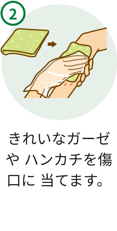 2 きれいなガーゼやハンカチを傷口に当てます。