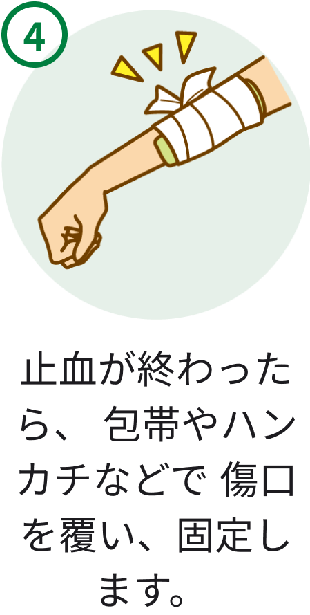 4 止血が終わったら、包帯やハンカチなどで傷口を覆い、固定します。