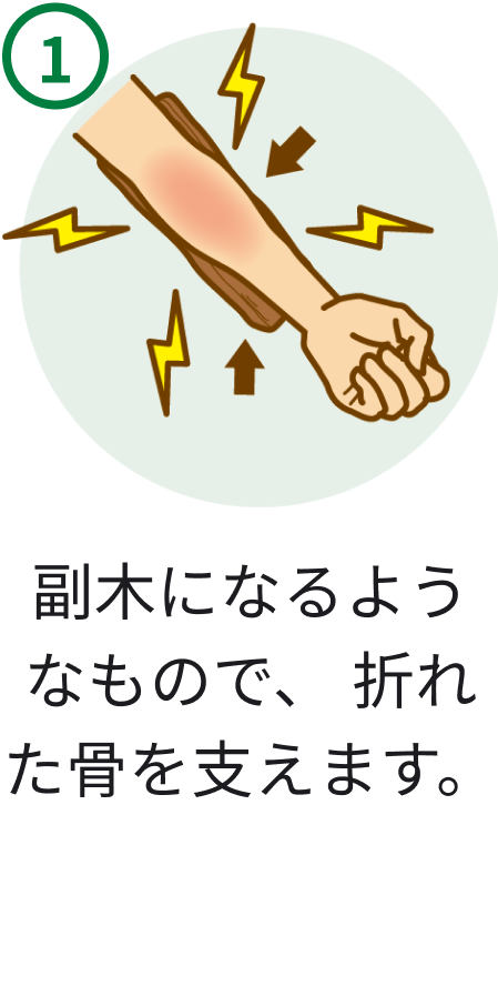 1 副木になるようなもので、折れた骨を支えます。