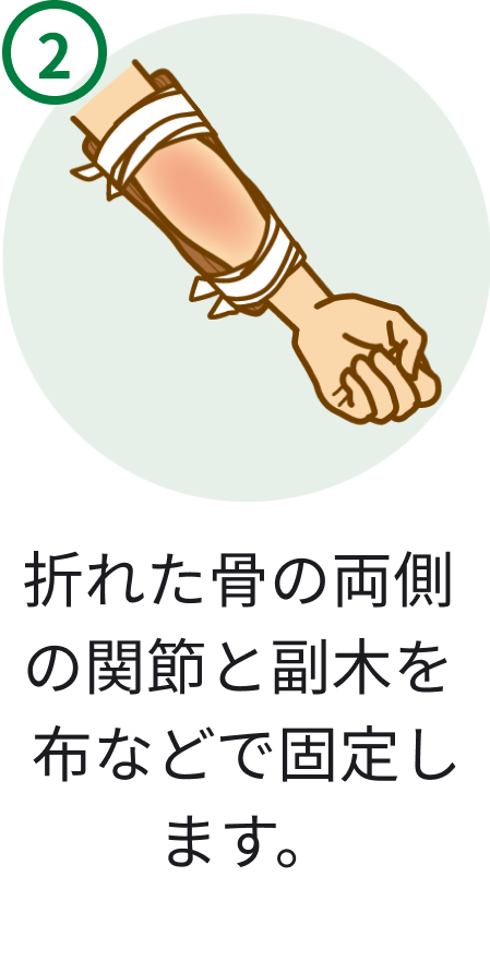 2 折れた骨の両側の関節と副木を布などで固定します。